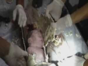 Bebê teve de ser levado para hospital dentro de cano - Reuters