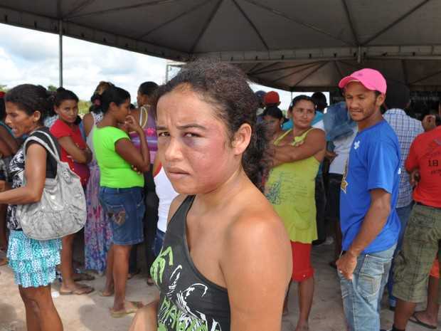 Mulher afirma ter sido agredida a socos pelo companheiro (Foto: Francisco Rocha/G1)