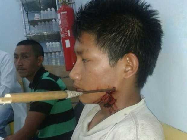 Indígena foi atingido com uma flechada na região do pescoço (Foto: Laudinei Sampaio/Arquivo Pessoal)