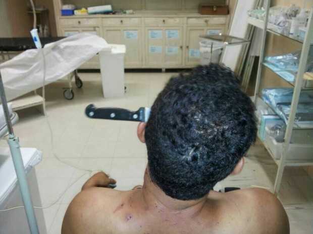 Homem ficou com faca cravada na cabeça em Agudos (Foto: Polícia Militar/Divulgação)