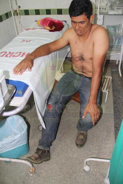 Cristiano de Souza Franco sofreu vários arranhões pelo corpo ao cair - Foto: Alexandre Lima
