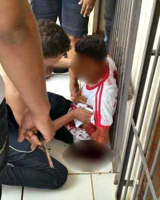 Aluno foi atingido por colega com golpes de tesoura dentro de escola na capital (Foto: Arquivo pessoal)