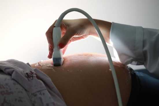 CFM disse que agência se comprometera a publicar nova instrução sobre partos
