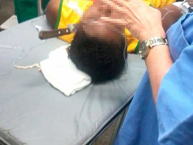 Jovem de 23 anos teve faca cravada na cabeça (Foto: Site Reclame Boca)