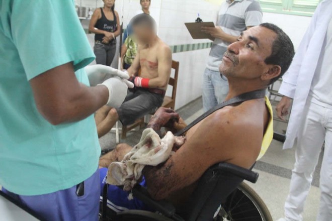 Seu José Alves de Moura, sofreu um grande ferimento no braço após esfaquear Elizeu - foto: Alexandre Lima