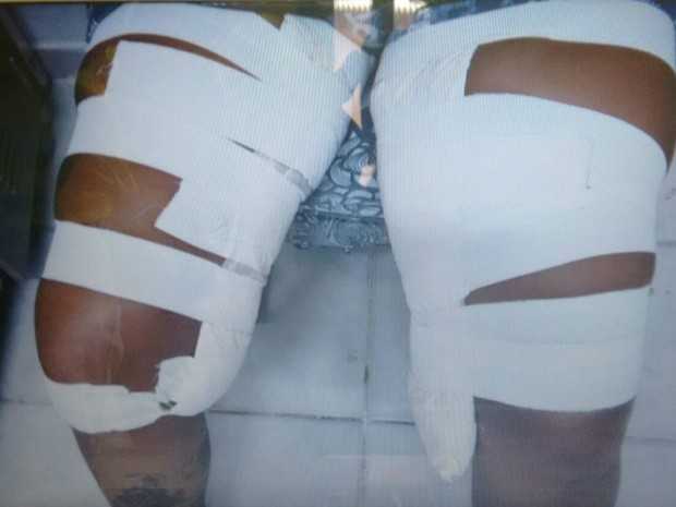 Mulher estava com 2 kg de pasta base de cocaína presos nas pernas (Foto: Divulgação/Polícia Civil)