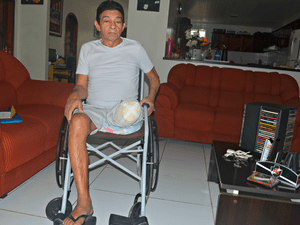 Pelegrino Thomaz amputou perna por complicações com DDT (Foto: Tácita Muniz/G1/Arquivo)