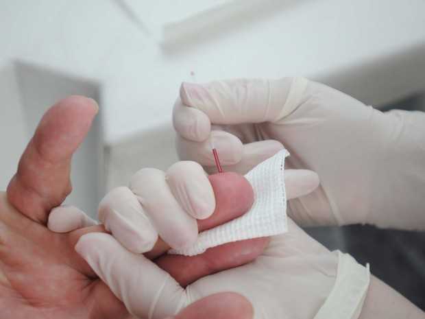 Teste de HIV é realizado de forma rápida, e resultado sai em 20 minutos (Foto: Veilton Küchler/ Divulgação/ Sesa-PR)