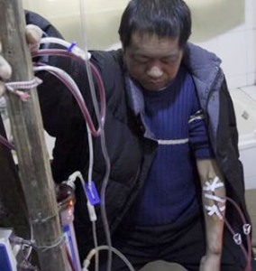 Sem dinheiro para ir ao hospital, Hu Songwen desenvolveu sua própria máquina de hemodiáliseFoto: AP