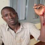 Haitiano Bamba Seck, de 25 anos, foi brutalmente espancado dentro do abrigo recentemente - Foto: Alemão Monteiro