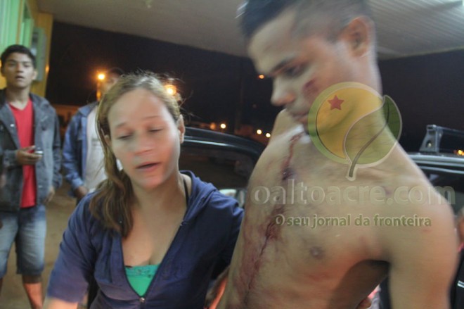     A vítima chegou andando após ser socorrido por parente e terceiros - Foto: Alexandre Lima