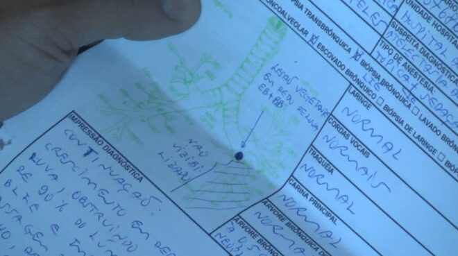 Júlio Cesar Ribeiro da Silva descobriu que é portador de Neoplasia maligna do pulmão por acaso - Foto:/captura