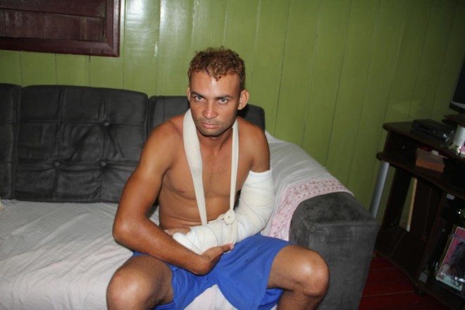 Edivaldo está com fratura  em dois lugares do braço e três costelas, além de levar pontos na cabeça e ferimentos pelo corpo - Foto: Alexandre Lima