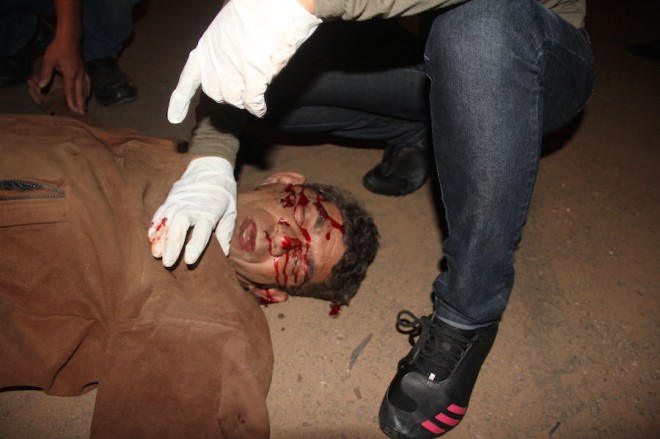 Francisco sofreu vários cortes pelo rosto e pernas - Foto: Alexandre Lima
