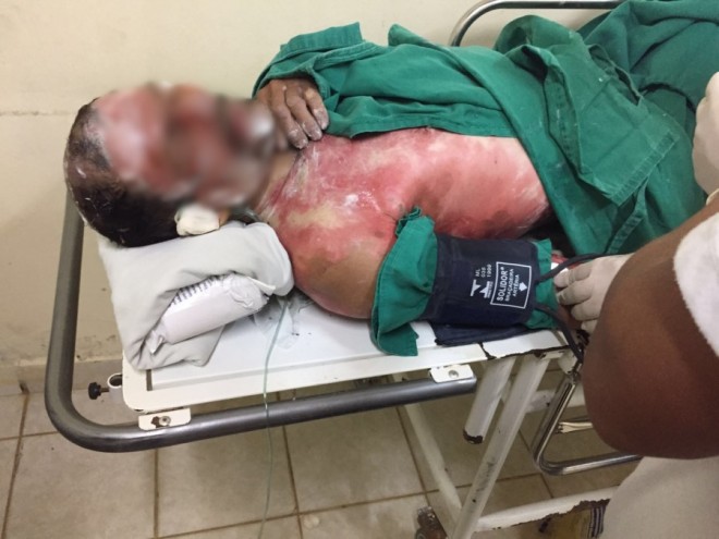 A vítima foi encaminhada ao Hospital de Urgência e Emergência de Rio Branco/Foto: ContilNet