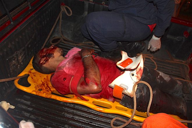 Alcimar chegou bastante machucado no hospital de Brasiléia,mas teve ser resgatado na carroceria de uma pick-up por falta de ambulâncias na fronteira - Foto: Alexandre Lima