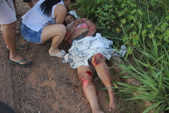 Mulheres que estava na moto com a criança ficaram bastante machucadas - Fotos: Alexandre Lima