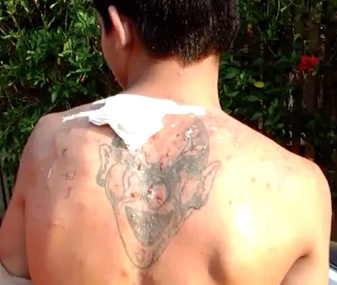 Dia da captura do menor no lado brasileiro, havia feridas em sua tatuagem e familiares acusam de terem raspado no centro para menores - Foto/captura