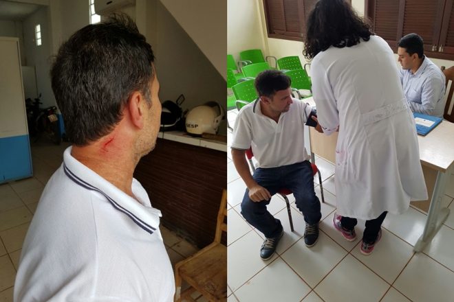 Jornalista procurou atendimento médico após agressão/Foto: Folha do Acre