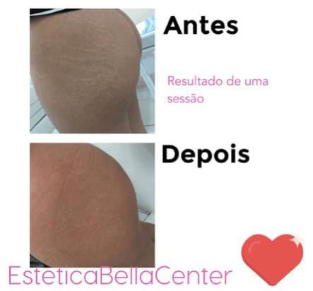 estetica