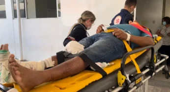 Ultrapassagem: motociclista tem múltiplas fraturas após bater em meio fio na Getúlio Vargas