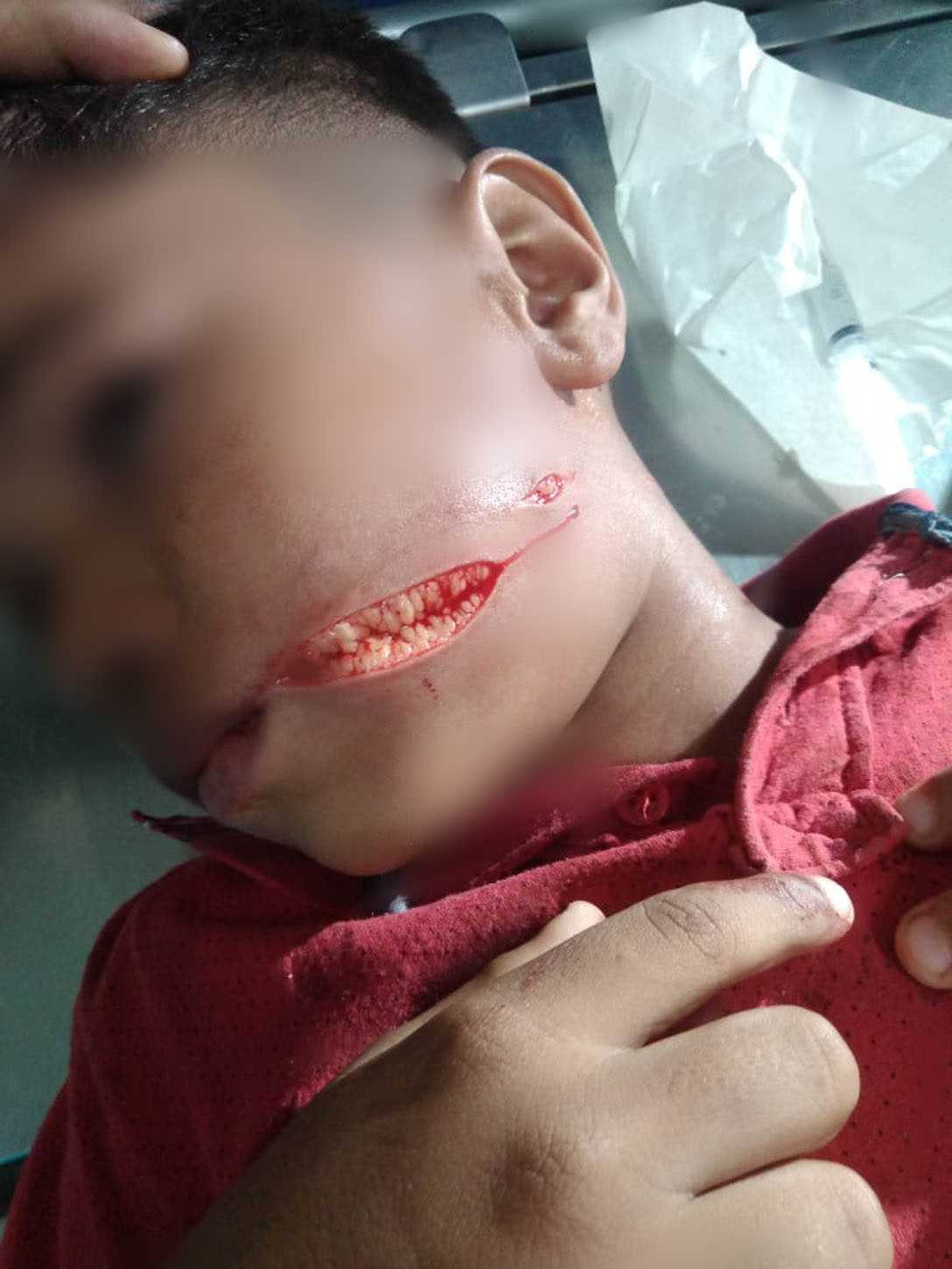 Imagens do garoto ferido cedidas pelo próprio pai.