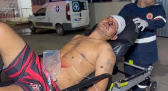 Briga entre amigos termina em agressão brutal com taco de sinuca em Porto Acre